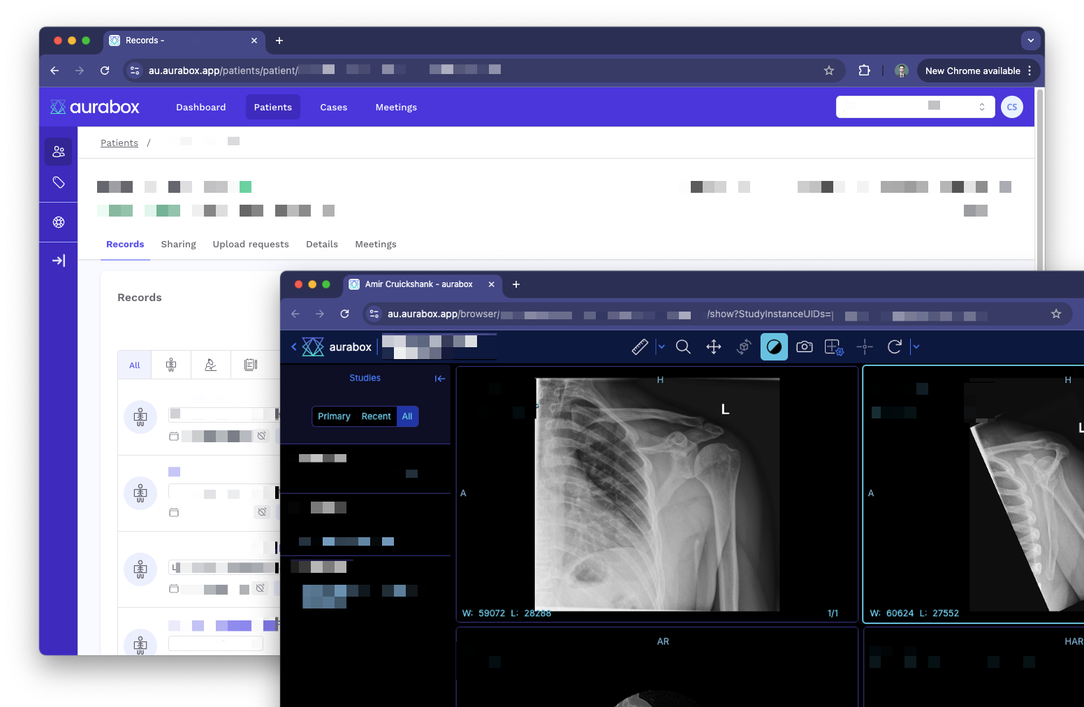 Ready for 2025: How Aurabox is Ahead of the Curve on Australian Privacy Law Reform
